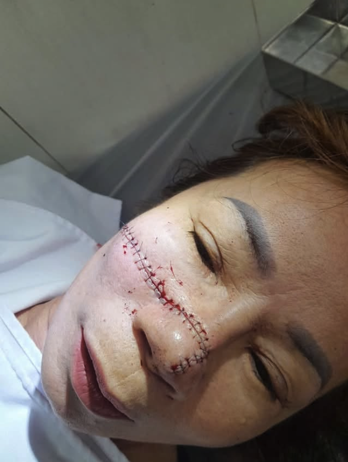 Hình ảnh liên quan vụ việc 1